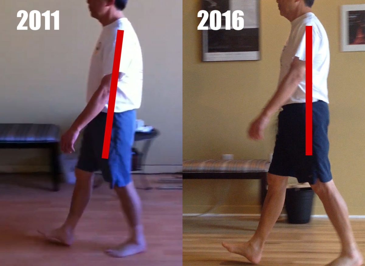 Gait Improvement